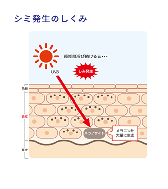 シミ発生の仕組み イメージ画像